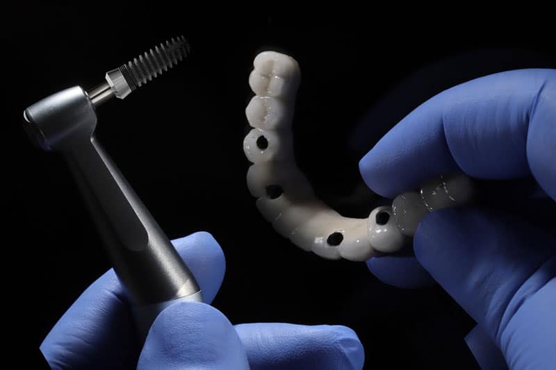dental implant model, denture, full mouth model with tool in hand, blue gloves, black background