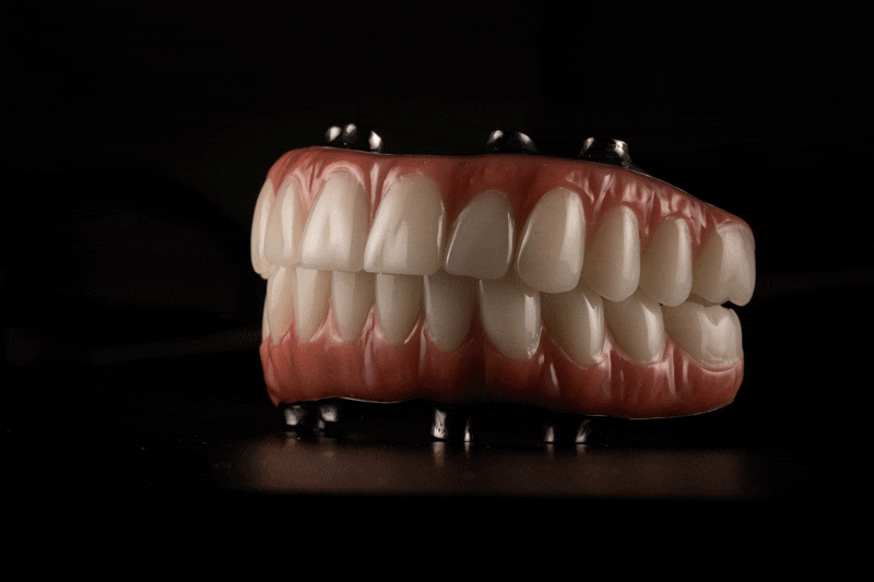 full mouth dental implants model, dark background